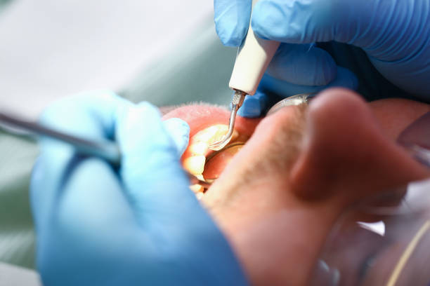Best Walk-In Emergency Dentist in Hapeville, GA