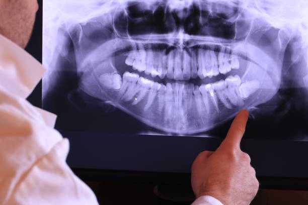 Best Emergency Treatment for Toothache in Hapeville, GA