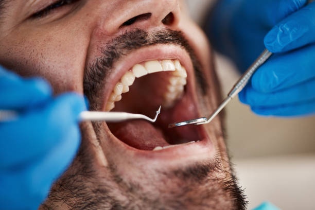 Best Emergency Root Canal Treatment in Hapeville, GA